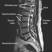 Lendenwirbelsäule